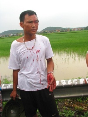Anh Nguyễn Văn Cường (trú tại xã Liên Bão, Tiên Du, tỉnh Bắc Ninh) bị những người tháp tùng đại đức Thích Tâm Mẫn đánh chảy máu đầu.